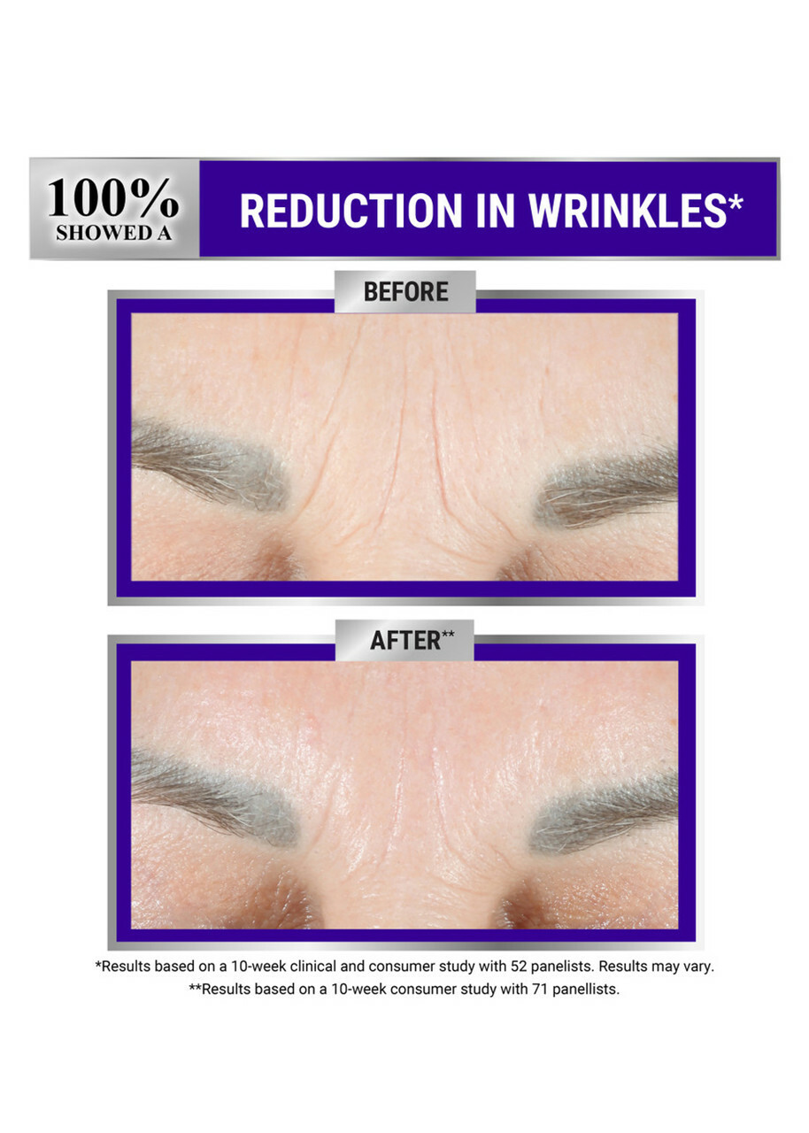 Kiehl's Retinol Skin-renewing Micro-dose Serum 50ml, Lotions, Retinol