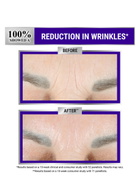 Kiehl's Retinol Skin-renewing Micro-dose Serum 50ml, Lotions, Retinol