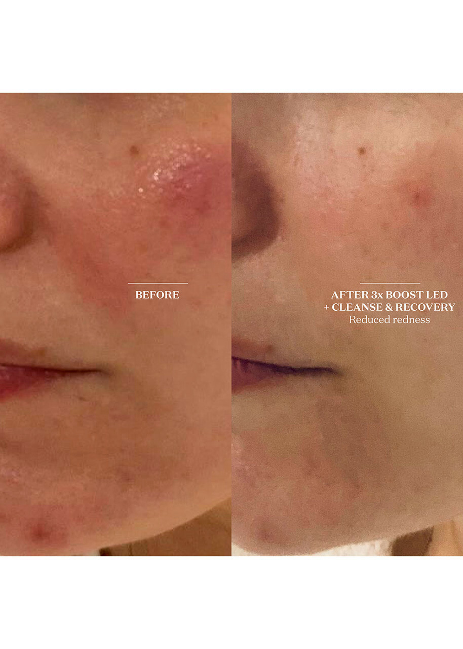 The Light Salon Boost Cleanse & Recovery Spray 100ml