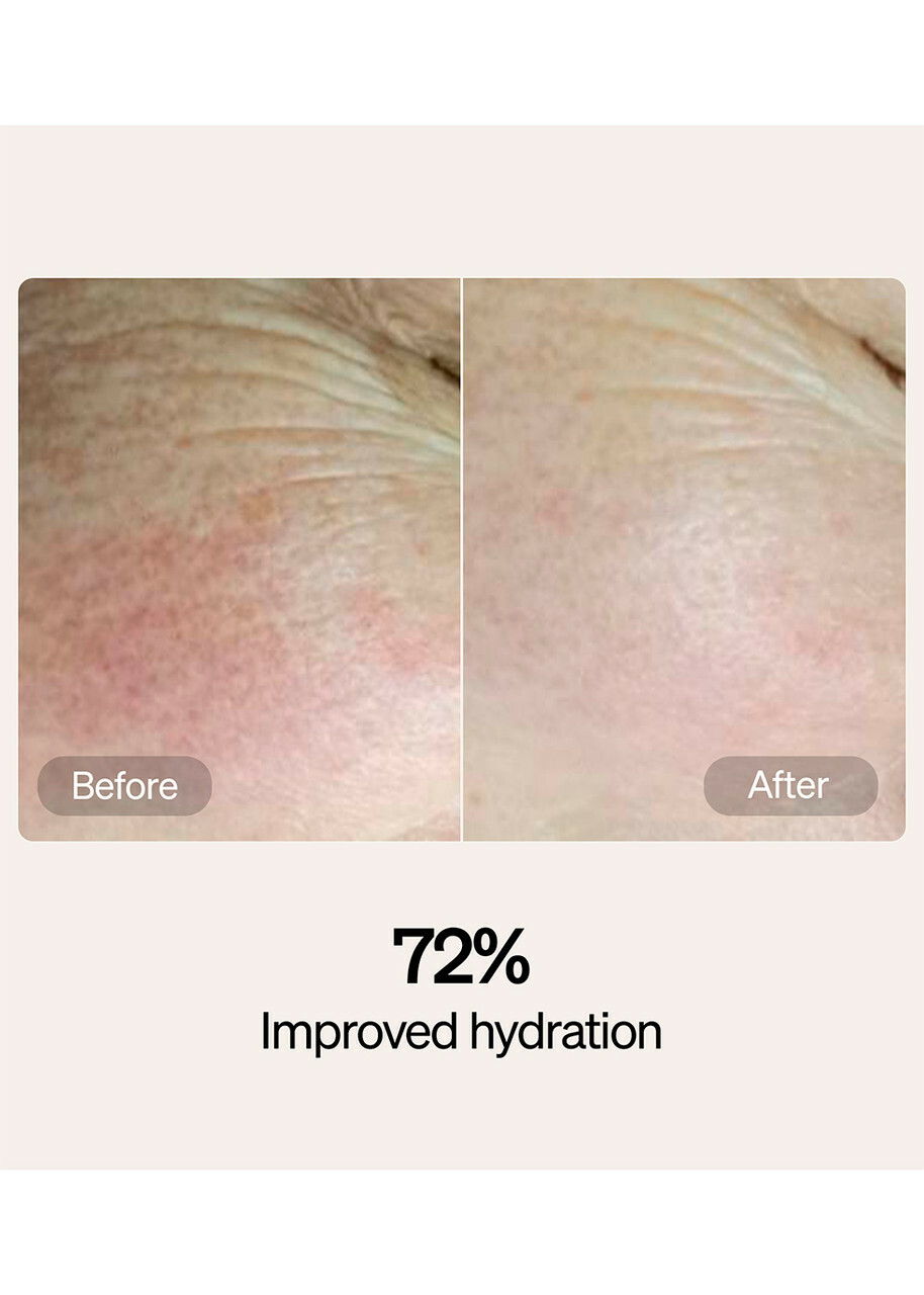 Lyma Serum & Cream Starter Kit, Moisturisers, Reduction in Redness