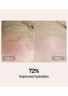 Lyma Serum & Cream Starter Kit, Moisturisers, Reduction in Redness