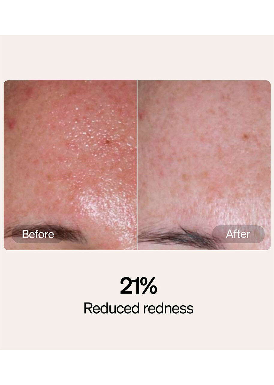 Lyma Serum & Cream Refills, Moisturisers, Brass, Tried and Tested