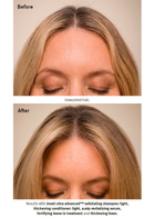 Aveda Invati Ultra Advanced System: Light