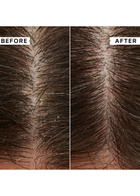 Philip Kingsley Flaky/itchy Scalp Mask 20ml X 2