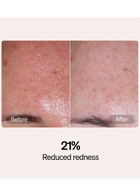 Lyma Serum & Cream Starter Kit, Moisturisers, Reduction in Redness