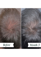 Philip Kingsley Density Preserving Scalp Drops 85ml
