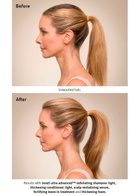Aveda Invati Ultra Advanced System: Light