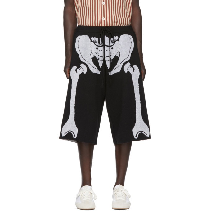 Photo: Loewe Black and White William De Morgan Skeleton Shorts