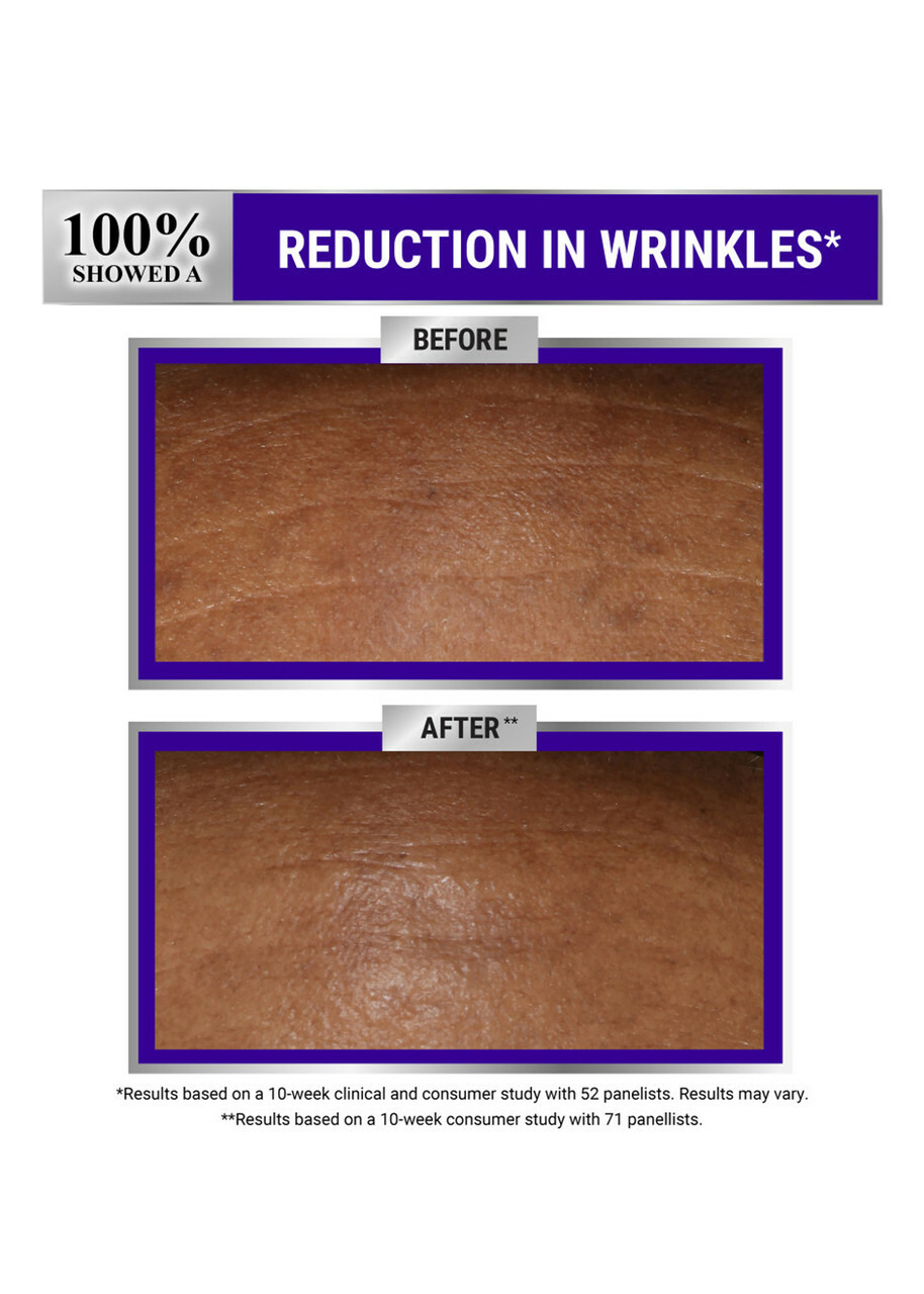 Kiehl's Retinol Skin-renewing Micro-dose Serum 50ml, Lotions, Retinol