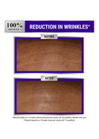 Kiehl's Retinol Skin-renewing Micro-dose Serum 50ml, Lotions, Retinol